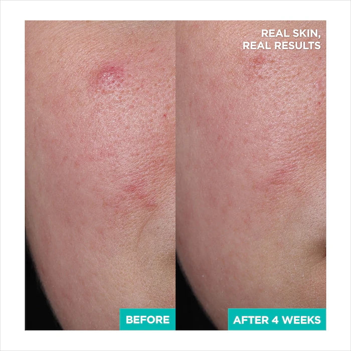 AESTURA - A-CICA365 Soothing Repair Gel Cream Moisturizer pH4.5 with Centella Asiatica + Panthenol for Redness