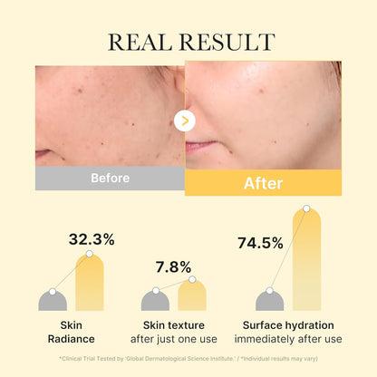 medicube - Kojic Acid Turmeric Brightening Gold Jelly Gel Mask