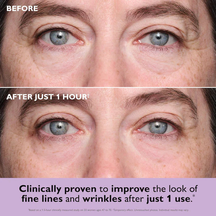 Peter Thomas Roth - Instant FIRMx® Collagen Tightening Eye Patches for Firming Under-Eye Bags & Wrinkles