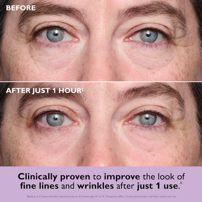 Peter Thomas Roth - Instant FIRMx® Collagen Tightening Eye Patches for Firming Under-Eye Bags & Wrinkles