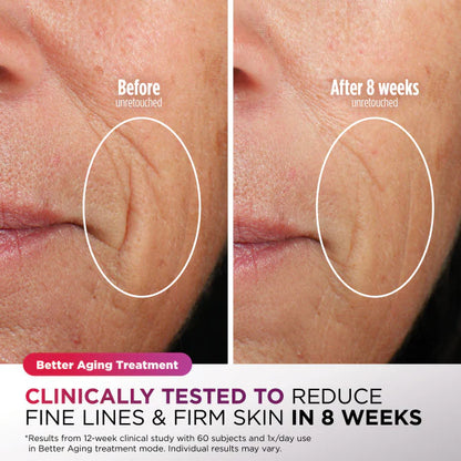 Shark Beauty - Shark™ CryoGlow™ Under-Eye Cooling + LED Anti-Aging Red Light & Skin Clearing Mask