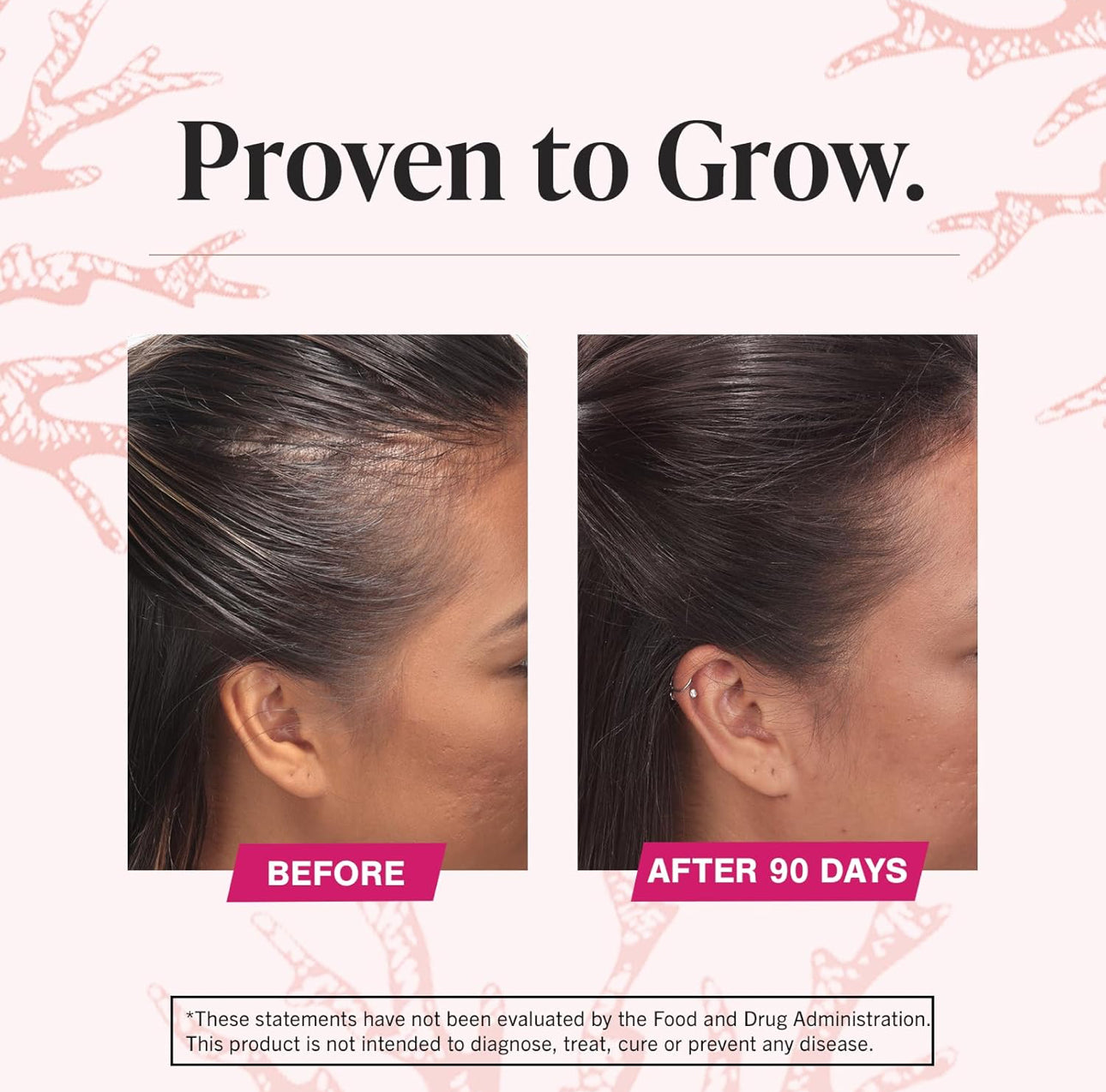 Viviscal Hair Growth
