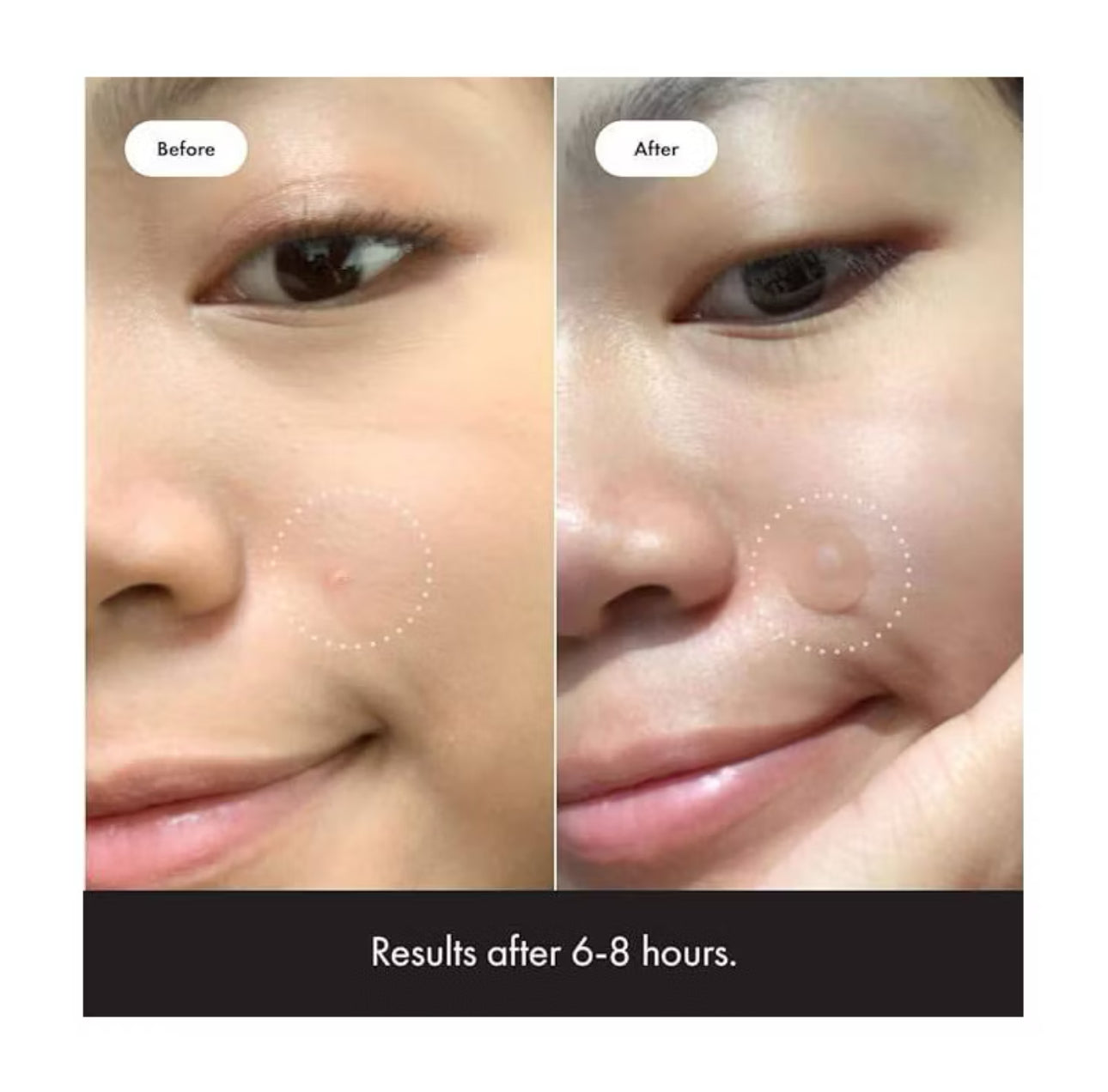 Hero Cosmetics Mighty Patch Original Acne Pimple Patches