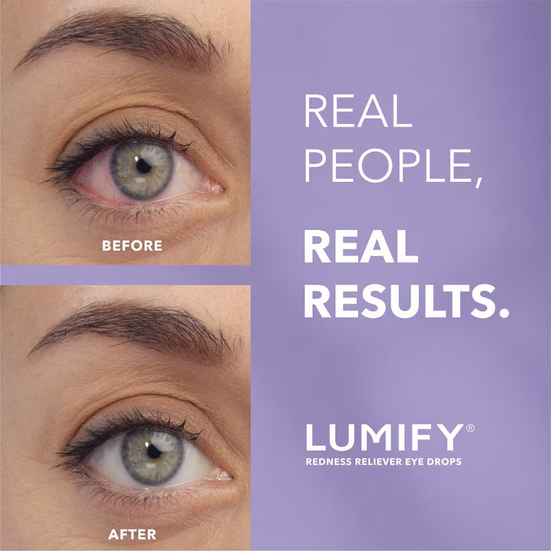 Lumify - Eye Drops for Redness Relief