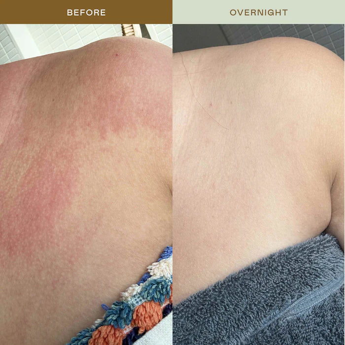 EADEM - Mami Wata Barrier Strengthening Face Mist with Cica, Panthenol, Ectoin for Sensitive, Irritated Skin