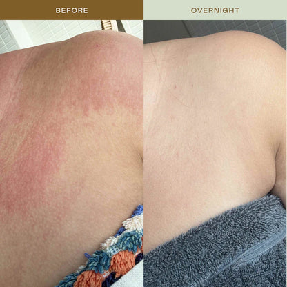 EADEM - Mami Wata Barrier Strengthening Face Mist with Cica, Panthenol, Ectoin for Sensitive, Irritated Skin