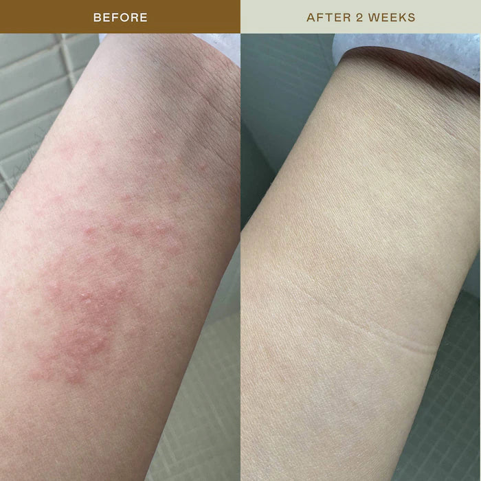 EADEM - Mami Wata Barrier Strengthening Face Mist with Cica, Panthenol, Ectoin for Sensitive, Irritated Skin