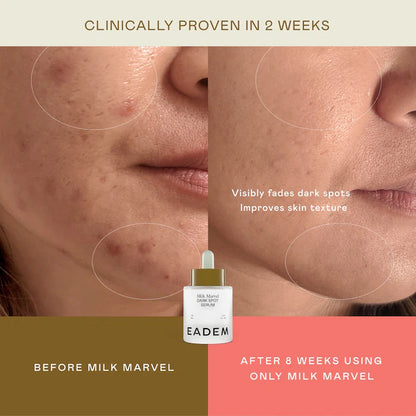 EADEM - Milk Marvel Dark Spot Serum with Niacinamide and Vitamin C