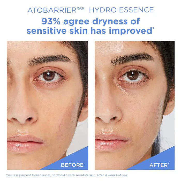AESTURA - ATOBARRIER365 Milky Hydro Essence with Hydrating Ceramides for Skin Moisture Barrier Repair