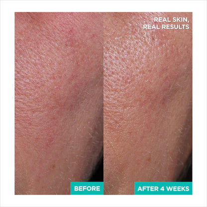 AESTURA - A-CICA365 Cooling Relief Toner Pads pH4.5 with Centella Asiatica + Hyaluronic Acid for Redness