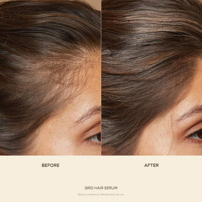 Vegamour GRO and Wash Hair Value Set