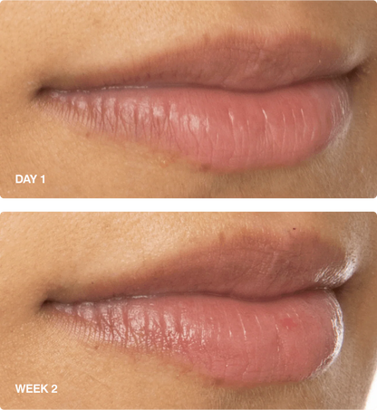 rhode - peptide lip boost
