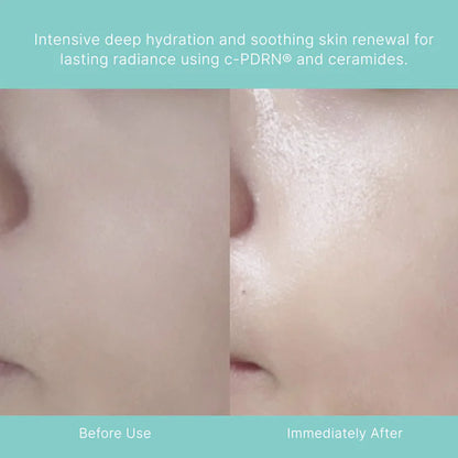 Rejuran - Turnover Mask c-PDRN® 5-Pack for Uneven Texture & Brightening Dull Skin