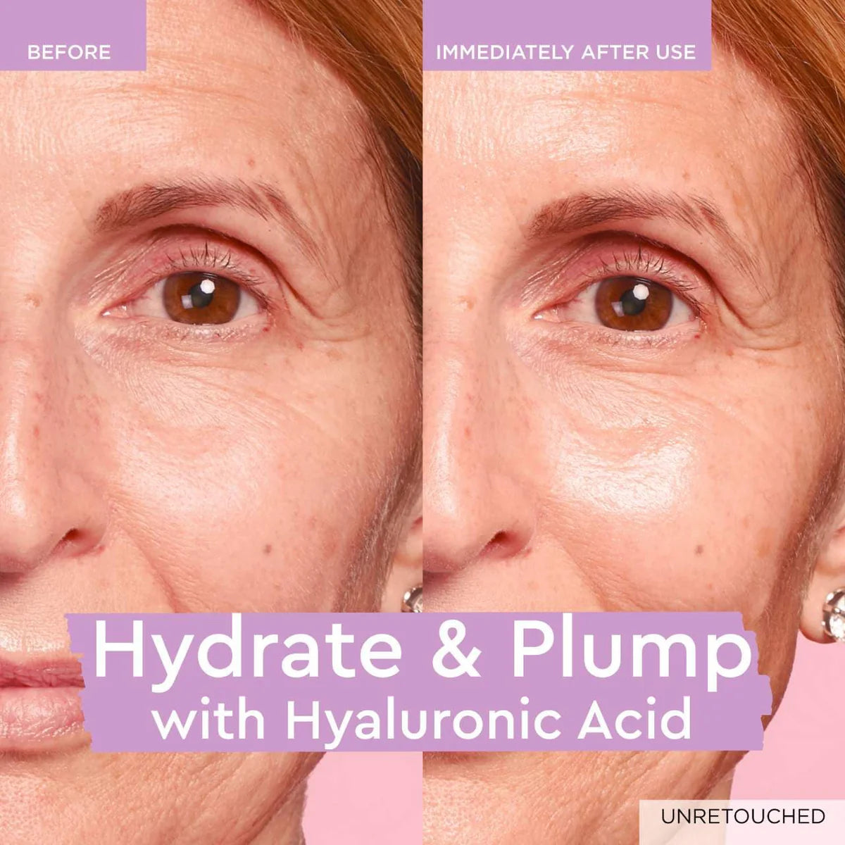 Plump + Hydrate Duo - edición limitada