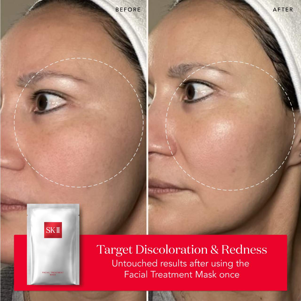 SK-II - Brightening Serum Facial Treatment Sheet Masks