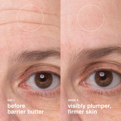 rhode - Barrier Butter Intensive Moisture Balm